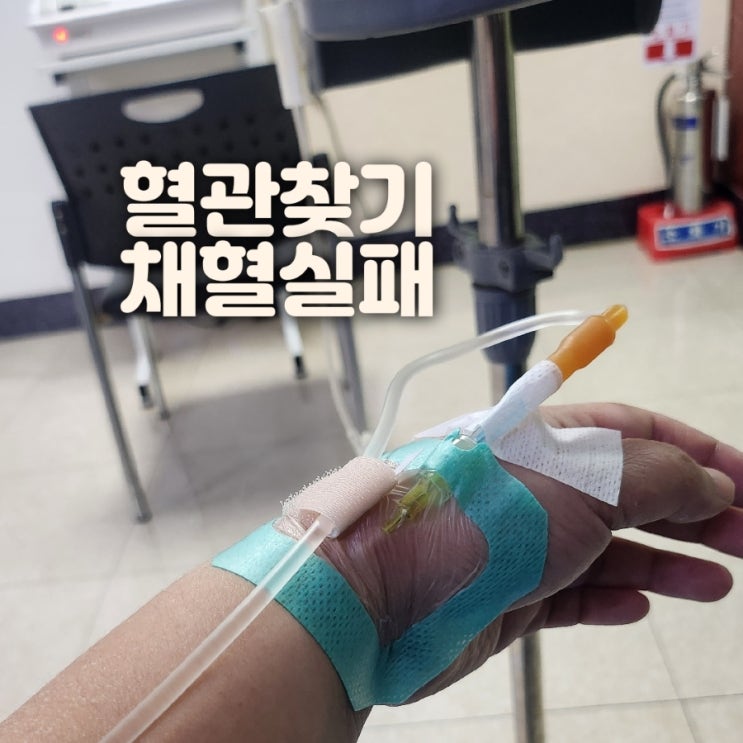 건강검진 혈관찾기 채혈 실패 이유?