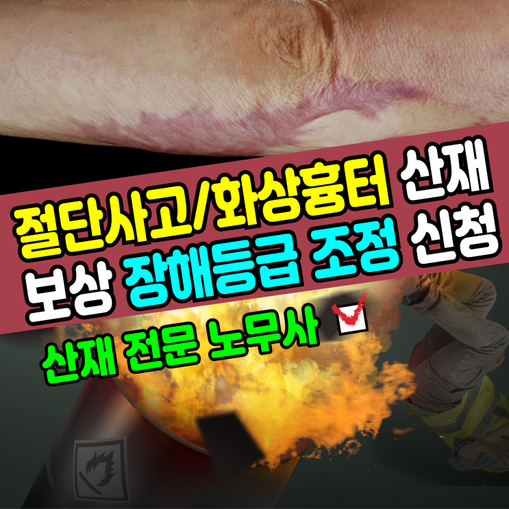  [산재 노무사] 절단사고 화상흉터 산업재해 보상 장해등급 조정 신청