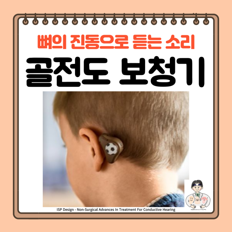  골전도 보청기, 원리 대상 착용 방법, 뼈의 진동으로 듣는 소리