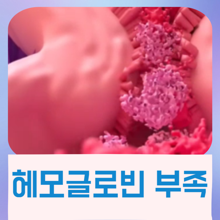  헤모글로빈 부족 뜻 철분과 빈혈