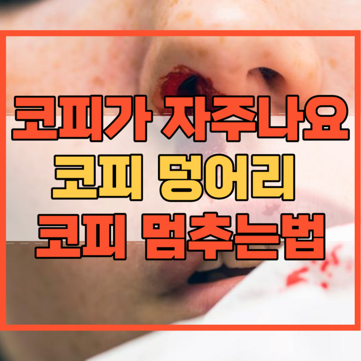  코피 덩어리 이유와 코피가 자주나요 멈추는법 알려드릴게요!