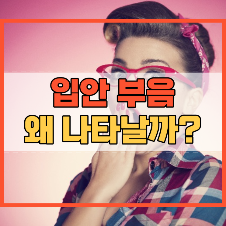  입안 부음 원인 및 예방 알고 계시나요?