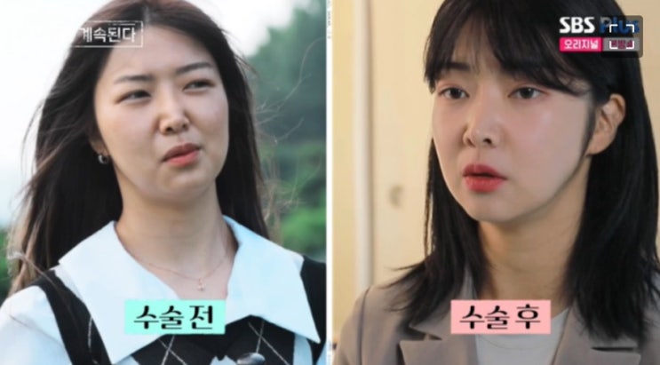 10기 영자 양악 수술 전후 연하남 남친 직장 삶의 전성기