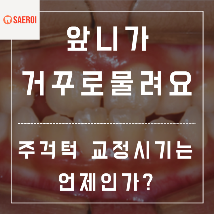  앞니가 거꾸로 물려요/주걱턱 원인과 교정시기는?