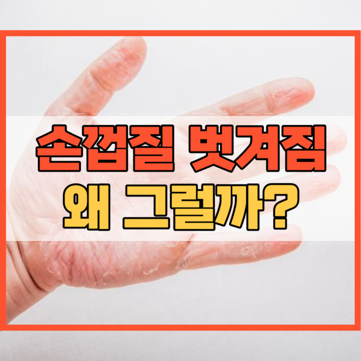  손껍질 벗겨짐 원인에 대해 알고 계시나요?