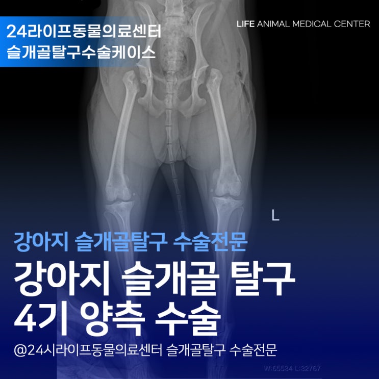 대구강아지슬개골탈구수술전문 : 포메 양측 슬개골 4기 수술했어요