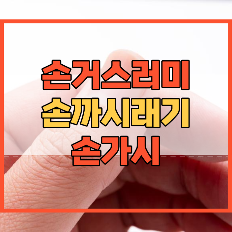  손거스러미 손까시래기 손가시 원인 및 제거 하는법!