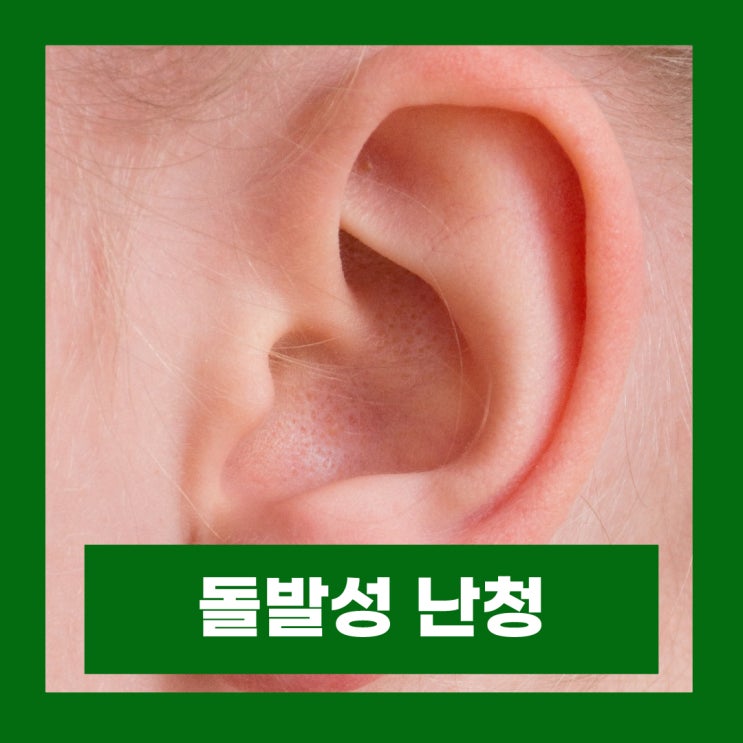  돌발성 난청 전조증상 치료 골든타임