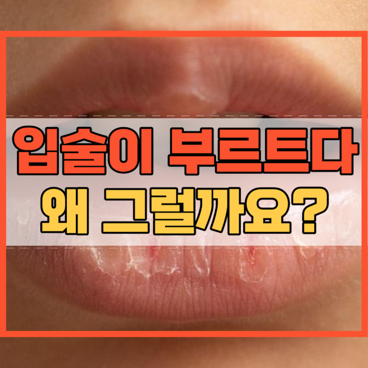  입술이 부르트다 트다 왜 그럴까요?