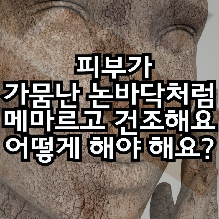  속건조 심한 피부관리 이렇게 해보세요!