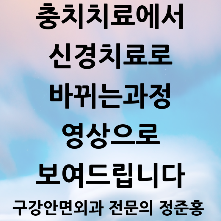  충치치료에서 신경치료로 넘어가는 과정 영상으로 보여드립니다