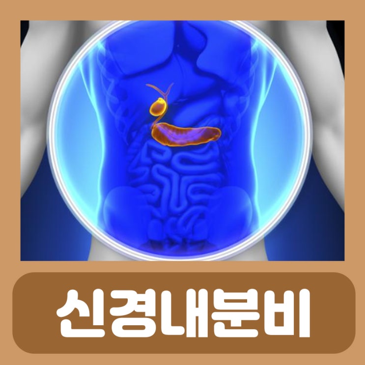  신경내분비 종양 신경내분비암 정리