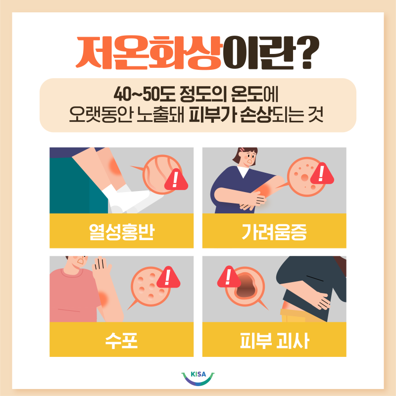 핫팩, 전기장판에 화상 입는다? 저온화상 증상과 예방법 : 네이버 블로그
