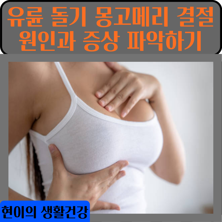  유륜 돌기 몽고메리 결절 원인과 증상