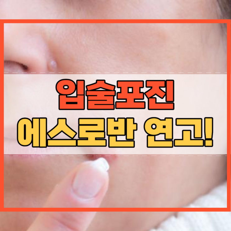  입술포진 에스로반 연고 사용법 포진 원인!