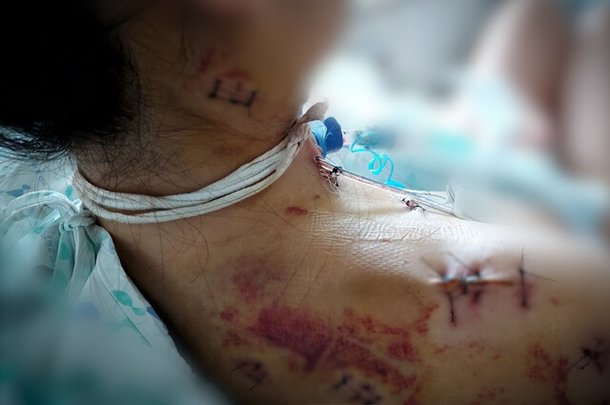 그날 이후 삶은 다 파괴됐다  <b>교제</b><b>살인 미수</b> 생존자의 넉 달