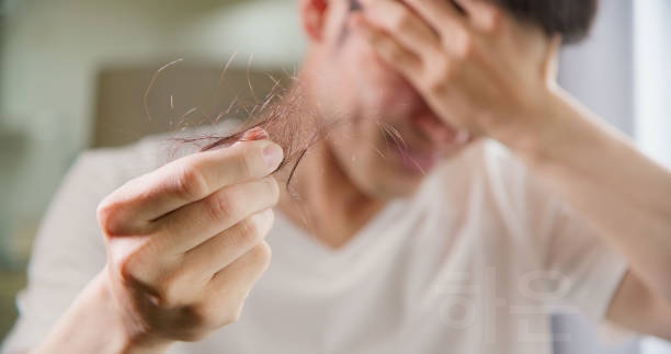 탈모의 종류, 머리카락이 빠지는 질병은?