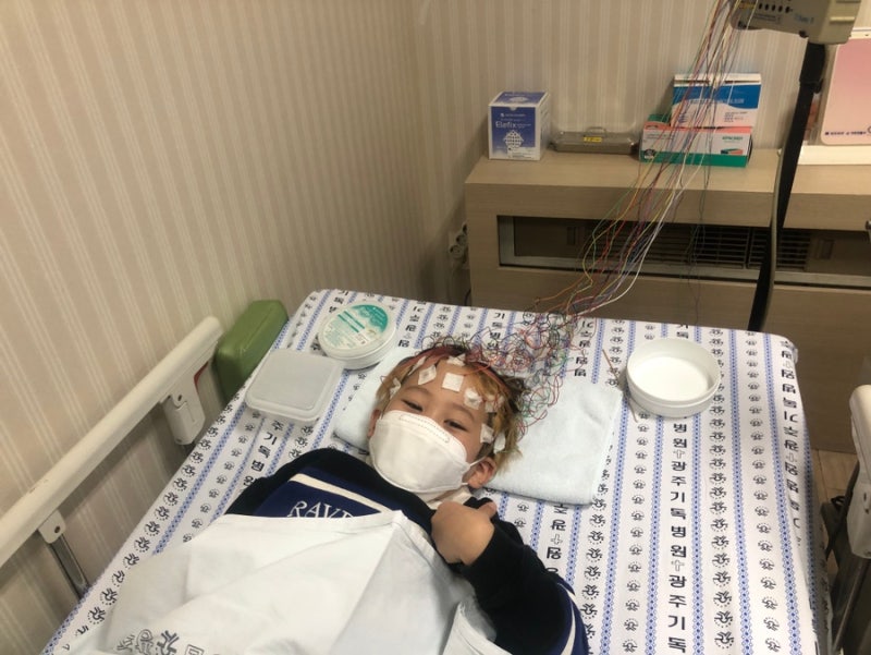 유아 열경련 뇌파 MRI검사 / 복합열성경련 /광주기독병원