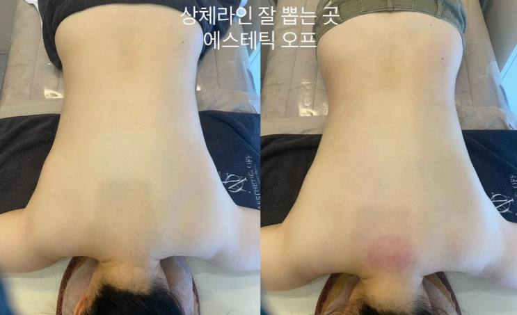  등관리, 뒷태도 챙기고 피로도 풀고!