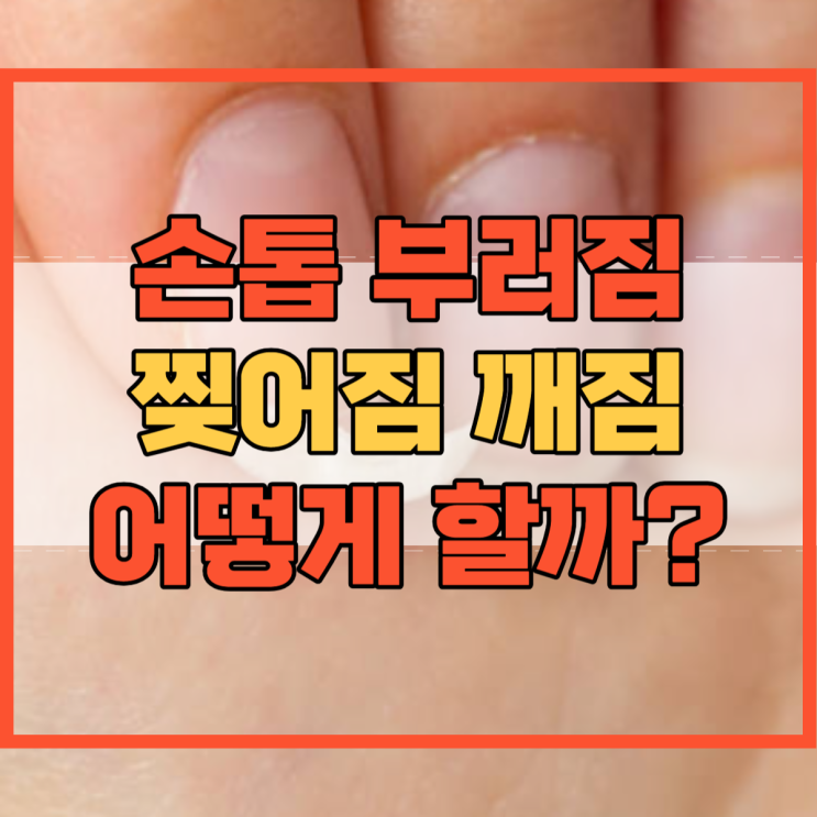  손톱 부러짐 부러졌을때 찢어짐 깨졌을때 어떻게 할까?