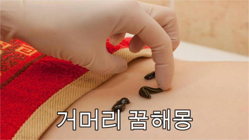 거머리 꿈해몽, 거머리가 몸에 붙은 꿈, 거머리 보는 꿈, 물속에 거머리를 본 꿈 꿈 해몽의 모....