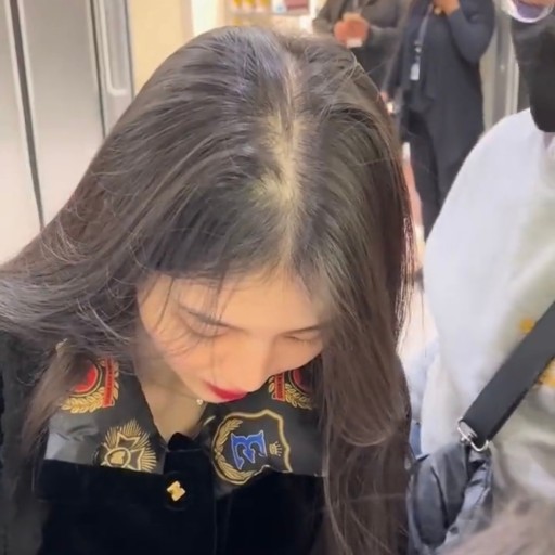  한소희 탈모! 여성 탈모 두피문신