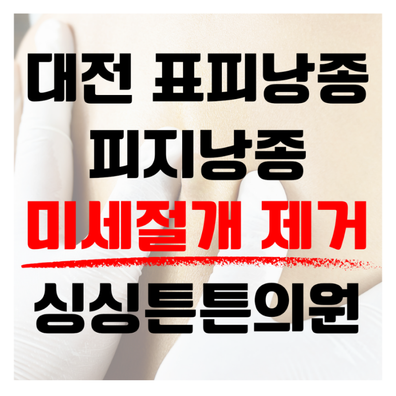 대전 둔산 표피낭종 피지낭종 방치하지 마시고 미세절개로 당일제거!