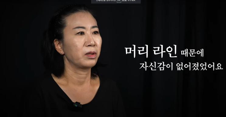  smp두피문신 나에게 적합한 방법으로