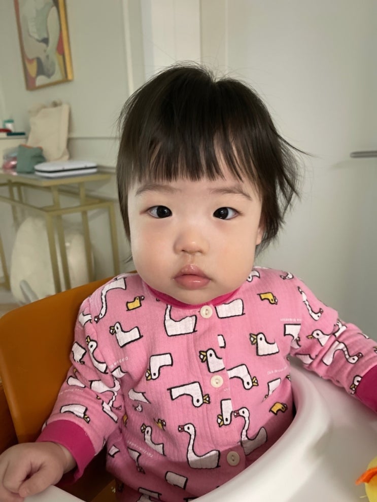  돌 지난 아기 내사시 의심으로 대학병원 다녀왔습니다 (꼭 소아안과 전문의로 가세요!)