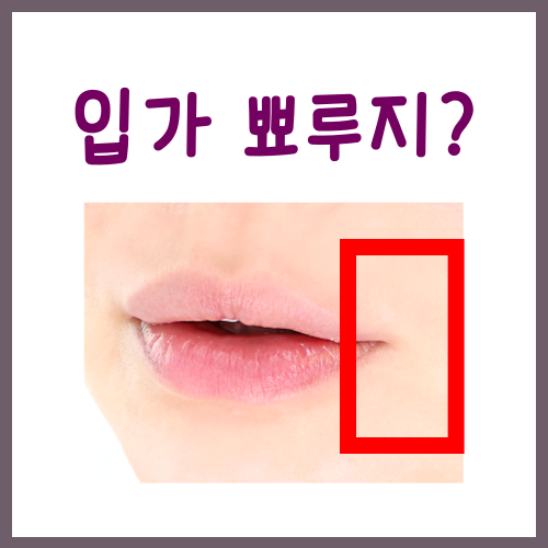  입가 뾰루지, 이 '3가지'가 무너져서 그런 겁니다
