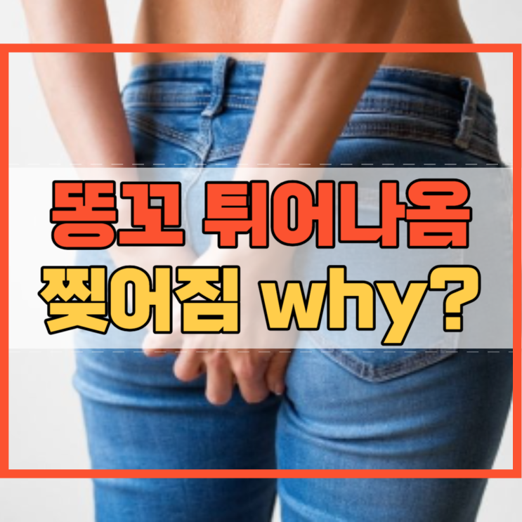  똥꼬 튀어나옴 및 찢어짐 증상에 대해 알고 계시나요?