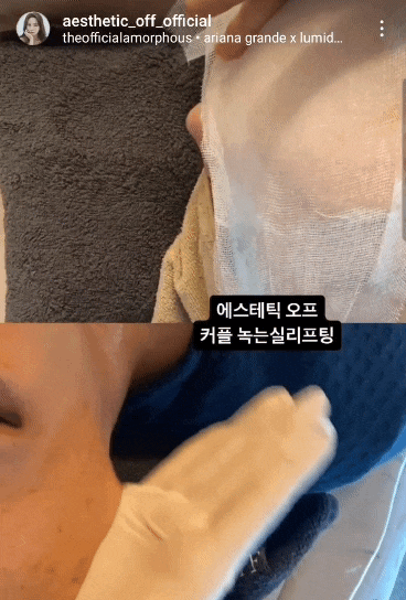  중요한 행사전엔 피부치트키 녹는실리프팅!