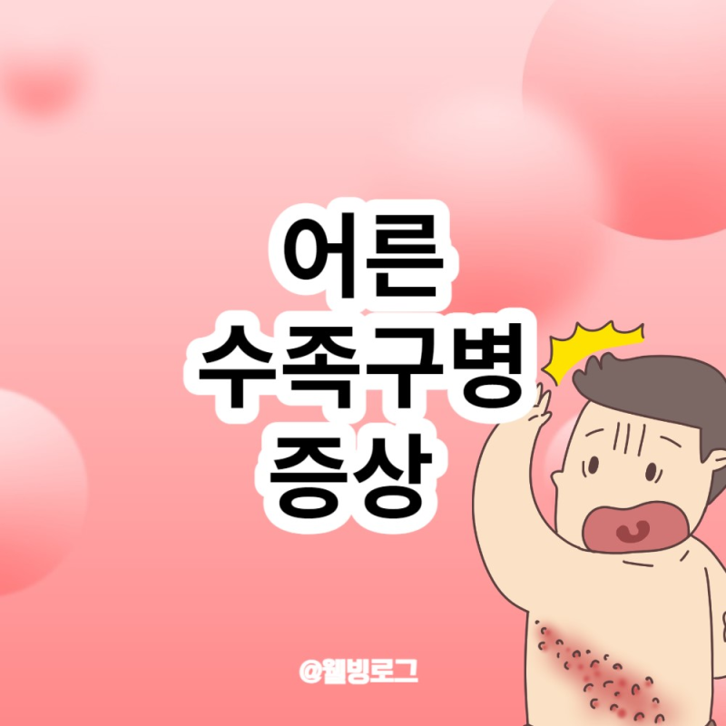 수족구 초기증상 수포 가려움 치료방법 : 네이버 블로그