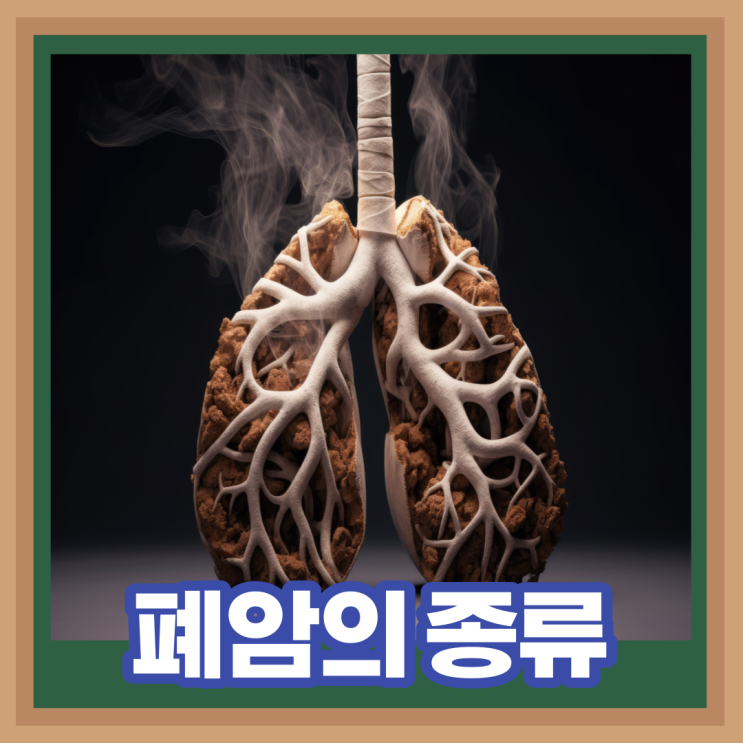  폐암의 초기 증상 및 종류 ( 비소세포암 , 소세포암 )
