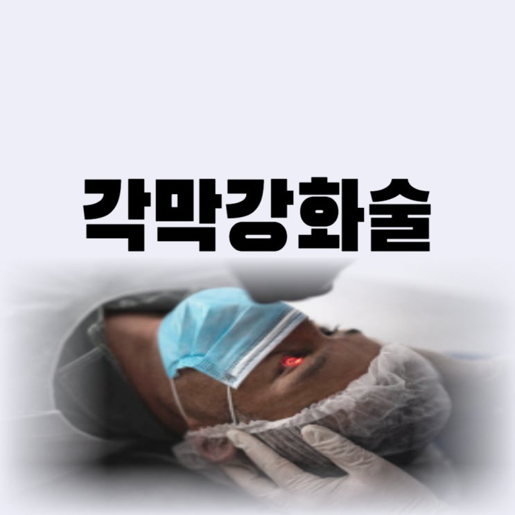  각막 강화술 부작용 비용 각막강화술 하는 게 좋을까