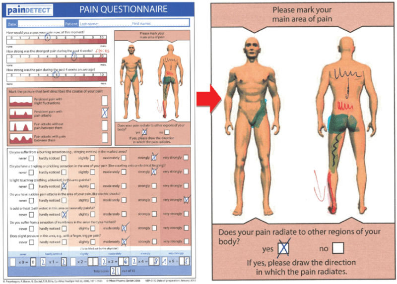 항암화학요법 유발 말초신경병증 (Chemotherapy Induced Peripheral Neuropathy) : 네이버 블로그