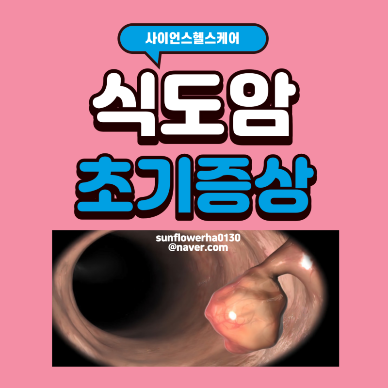 식도암 초기 증상 3,4기 증상 초기 수술로 완치가 가능할까?
