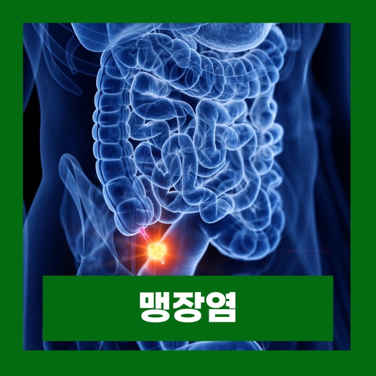  맹장염 원인 초기증상 남자 여자 맹장 위치 충수염 수술 회복 시간