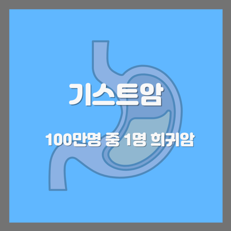  기스트암이란 무엇인가? 100만명 중 1명 꼴 희귀암