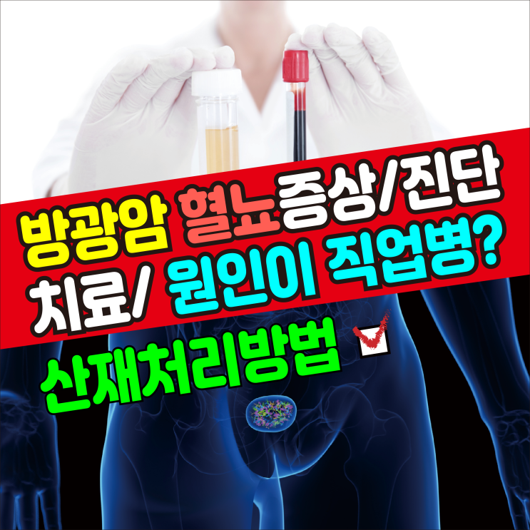  [건강정보] 혈뇨 방광암(증상/진단/치료/원인) 직업병 산재처리방법