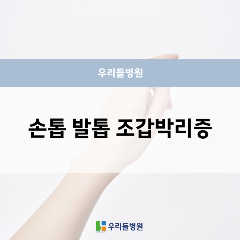 손톱 발톱 조갑박리증 연고, 치료, 병원은?