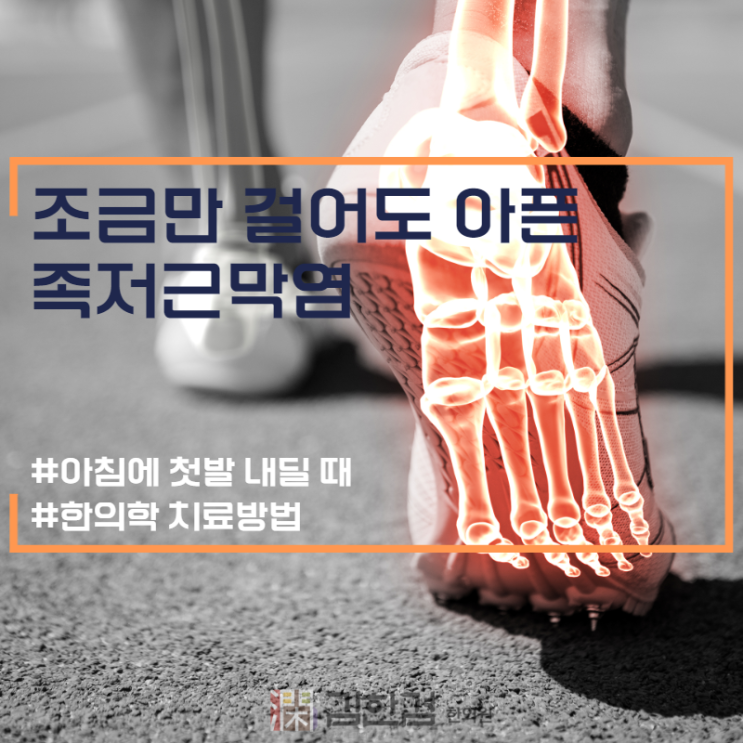  분당족저근막염 조금만 걸어도 아플때 한의원 치료
