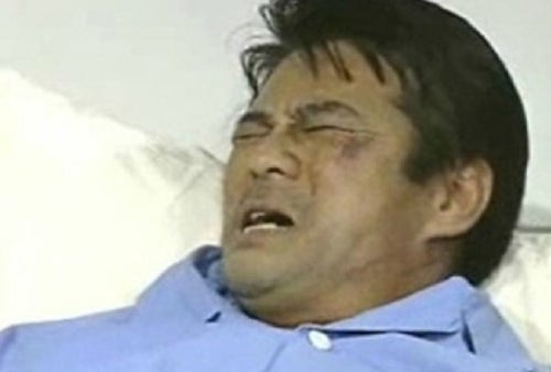 40대 아재들 주의보! 내가 통풍이라니 40대 아재들 주의보! 내가 통풍이라니