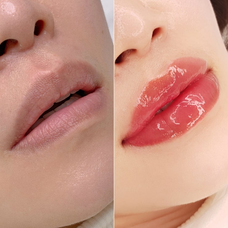  마곡 입술색소침착 타투 전후, 주의사항 관리법