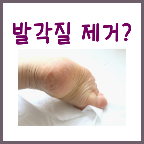  발각질 제거법? 딱 '3가지'만 그대로 따라하십시오