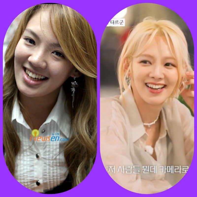 소녀시대 효연 데뷔초 얼굴 성형 근황