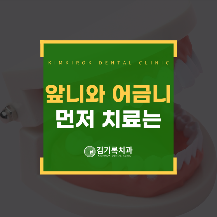 영통과잉진료안하는치과 앞니 or 어금니 어느 것부터 치료해야 할까요 치료순서