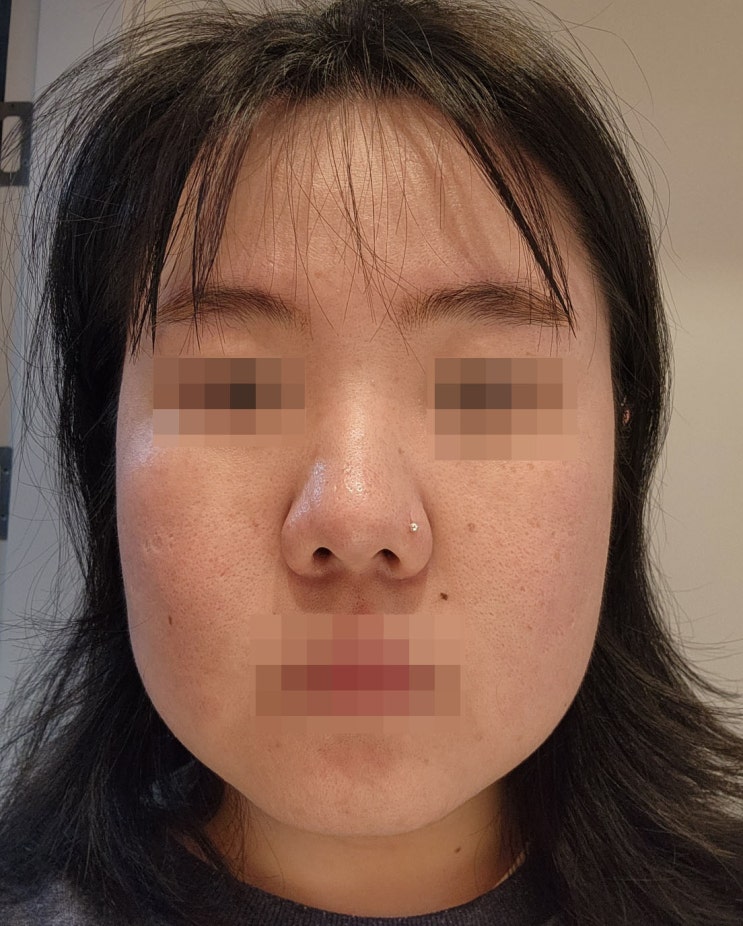  올리지업, 올리지오 효과 내돈내산 300샷 후기