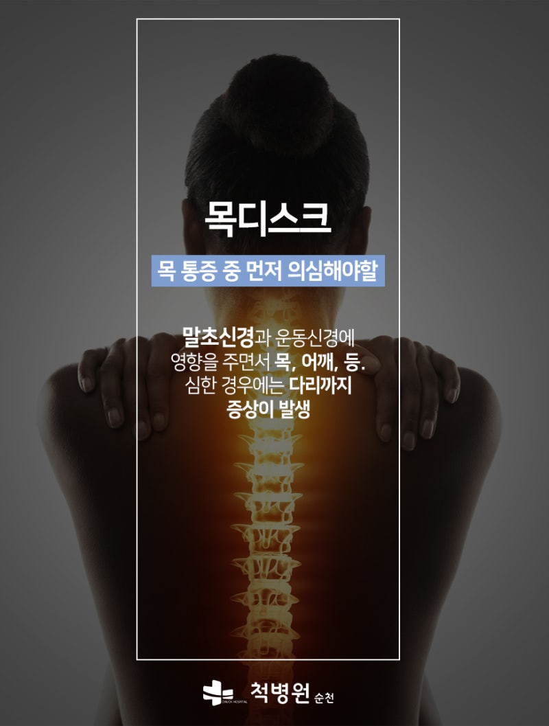 순천목디스크 : 수술의 부담 줄인 PSCD(핀셋치료)