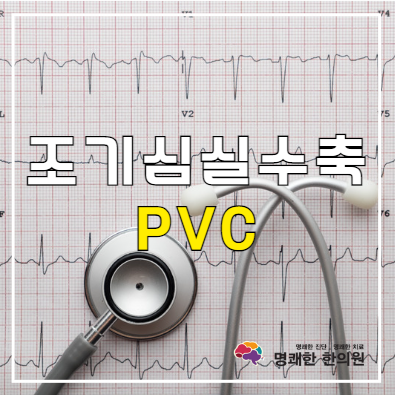 의학용어 PVC(VES, VPC) 증상, 원인, 진단 방법